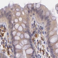 HPA IHC Colon — CCL17