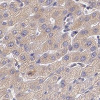 HPA IHC Liver — CCL17