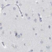 HPA IHC Cerebral cortex — PDX1