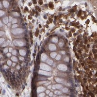 HPA IHC Colon — GRB2