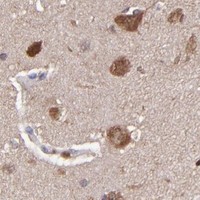 HPA IHC Cerebral cortex — GRB2