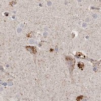 HPA IHC Cerebral cortex — PLOD2