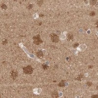 HPA IHC Cerebral cortex — YWHAH