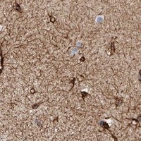 HPA IHC Cerebral cortex — PLEC