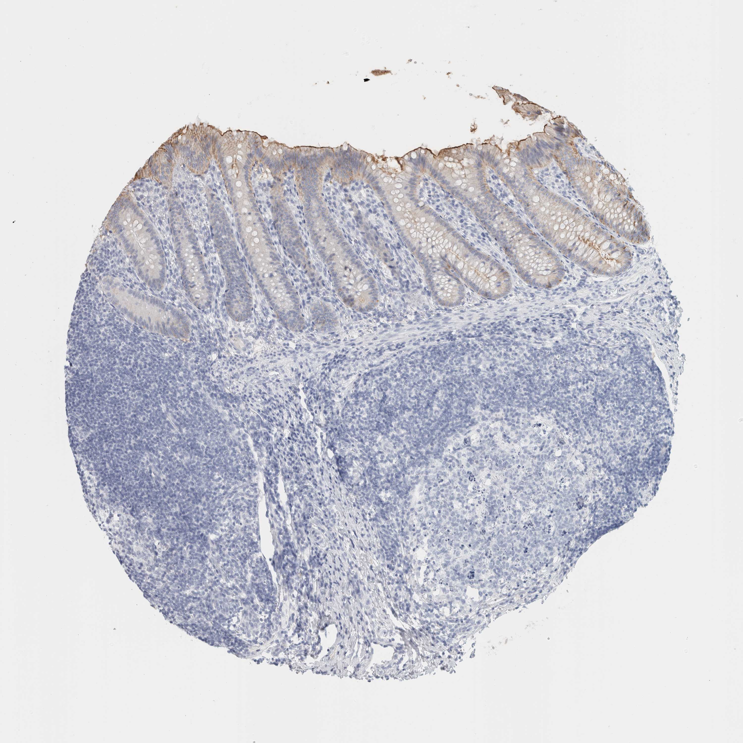 Tissue expression of TSPAN8 Staining in appendix The Human Protein