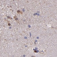 HPA IHC Cerebral cortex — S100A6