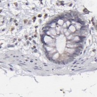 HPA IHC Colon — CLDN2