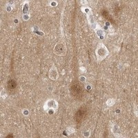 HPA IHC Cerebral cortex — PTK2B