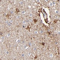 HPA IHC Caudate — AURKA