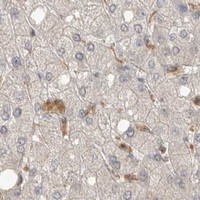 HPA IHC Liver — MAP2K1