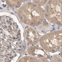 HPA IHC Kidney — MAP2K1