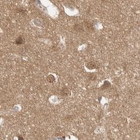HPA IHC Cerebral cortex — MAP2K1