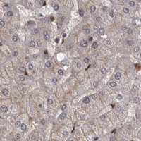 HPA IHC Liver — AKT3