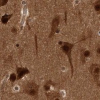 HPA IHC Cerebral cortex — AKT3