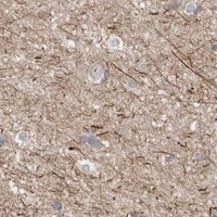 HPA IHC Cerebral cortex — DARS2