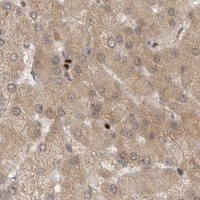 HPA IHC Liver — KDM8