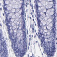 HPA IHC Colon — CNP
