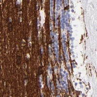 HPA IHC Cerebellum — CNP