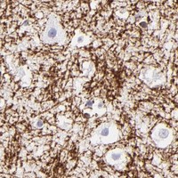 HPA IHC Cerebral cortex — CNP
