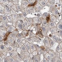 HPA IHC Liver — NECTIN1