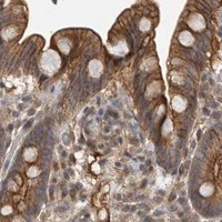 HPA IHC Colon — NECTIN1