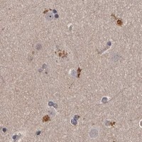 HPA IHC Cerebral cortex — CYP1B1