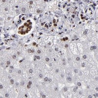 HPA IHC Liver — MRE11