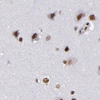 HPA IHC Cerebral cortex — MRE11