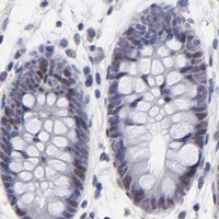 HPA IHC Colon — DNMT1