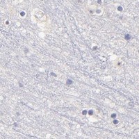 HPA IHC Cerebral cortex — DNMT1