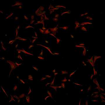 HPA027163: U2OS, siRNA 1 (10x)