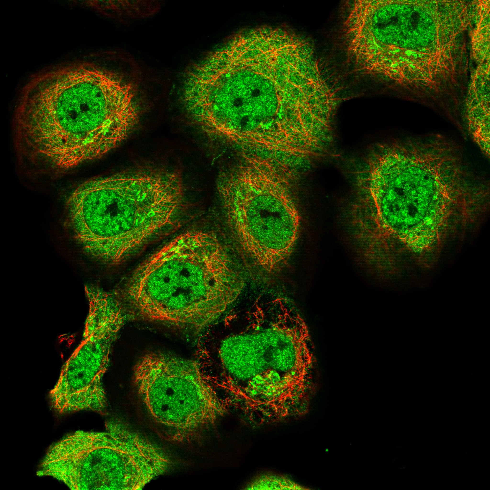 Subcellular WDR77 The Human Protein Atlas