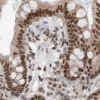 HPA IHC Colon — BLZF1