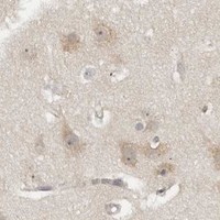 HPA IHC Cerebral cortex — HTRA2