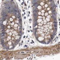HPA IHC Colon — OXR1