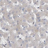 HPA IHC Liver — OXR1