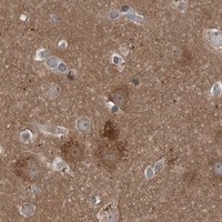 HPA IHC Cerebral cortex — GAK