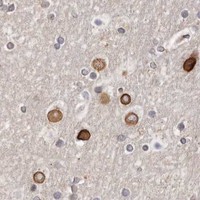 HPA IHC Cerebral cortex — HASPIN