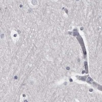 HPA IHC Cerebral cortex — CGN
