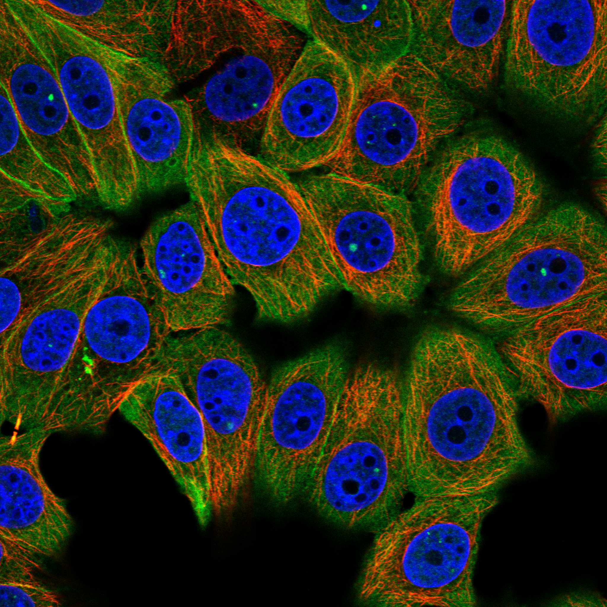 Subcellular S100A14 The Human Protein Atlas