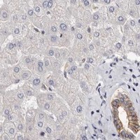 HPA IHC Liver — S100A14