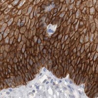HPA IHC Esophagus — S100A14