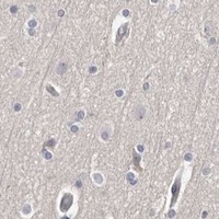 HPA IHC Cerebral cortex — S100A14