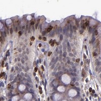 HPA IHC Colon — SLC2A3