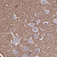 HPA IHC Cerebral cortex — SLC2A3