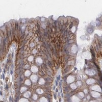 HPA IHC Colon — ARF6