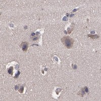 HPA IHC Cerebral cortex — ARF6