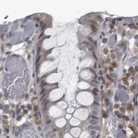 HPA IHC Colon — RTCA