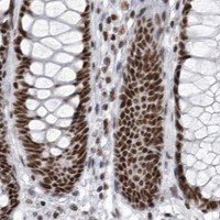 HPA IHC Colon — DHX9