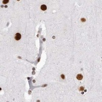 HPA IHC Cerebral cortex — DHX9